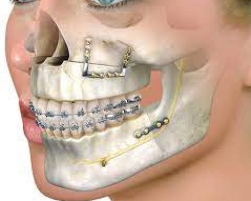 Facial Trauma Management