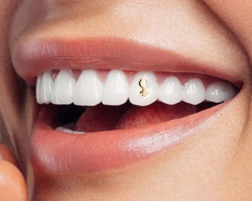 Tooth jewelry