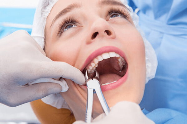maintain-oral-hygiene-after-tooth-extraction